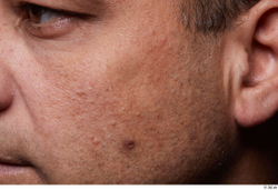 Eye Face Cheek Ear Hair Skin Man Birthmarks Chubby Wrinkles Studio photo references
